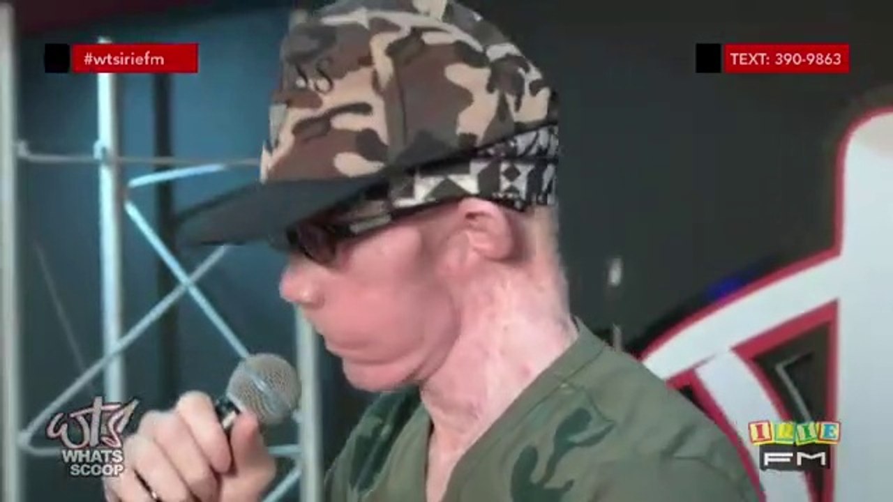 KING YELLOWMAN live performance in Ocho Rios Jamaica