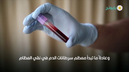 أعراض سرطان الدم المتأخرة