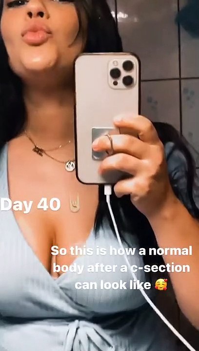 Λάουρα Νάργιες: Μας δείχνει το σώμα της 40 μέρες μετά τη γέννηση του γιου της