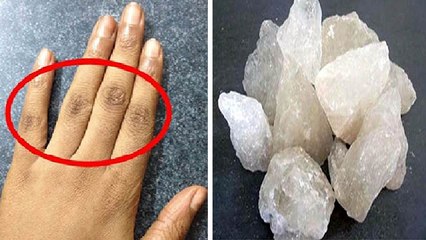 उँगलियों का कालापन मिनटों मे दूर करेगी फिटकरी बस जान लें इस्तेमाल करने का ये तरीका | Boldsky *Health
