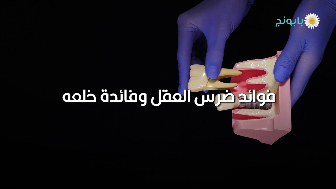 فوائد ضرس العقل وفائدة خلعه