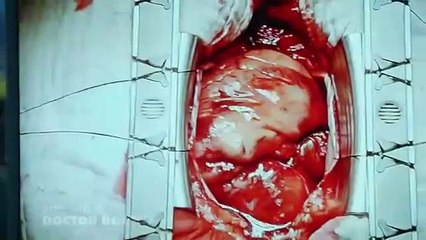Doctor Doctor - Se1 - Ep06 HD Watch HD Deutsch