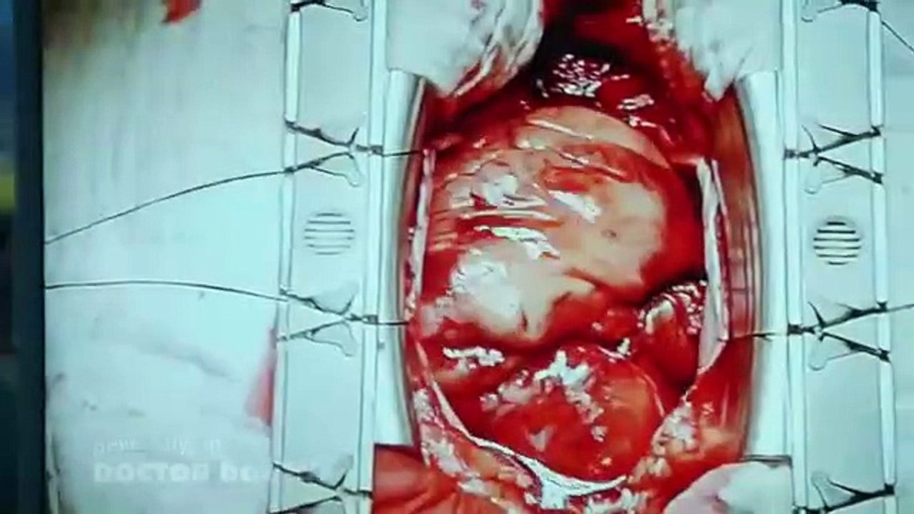 Doctor Doctor - Se1 - Ep06 HD Watch HD Deutsch