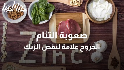 ما هي أبرز علامات واعراض نقص الزنك في الجسم