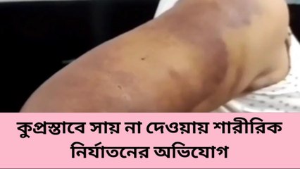 হাওড়াঃকুপ্রস্তাবে &#039;না&#039;! মহিলাকে বেধড়ক মারের অভিযোগ অভিযুক্তের পরিবারের বিরুদ্ধে