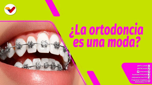 Buena Vibra | ¿La ortodoncia es necesaria o es una moda?