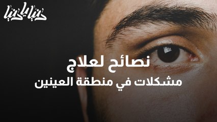نصائح لعلاج مشكلات في منطقة العينين