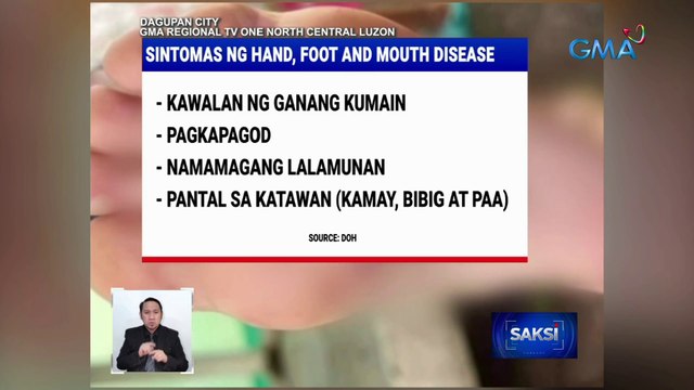 Region 1, may 145 nang kaso ng hand, foot and mouth disease | Saksi