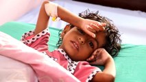 جراء سوء التغذية.. مرض التقزم المزمن يفتك بأطفال اليمن
