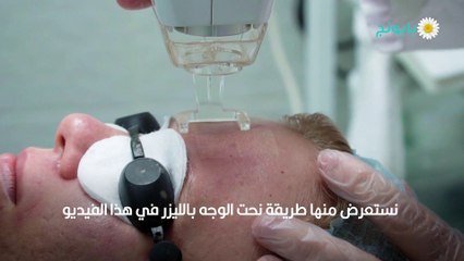 عملية نحت الوجه بالليزر
