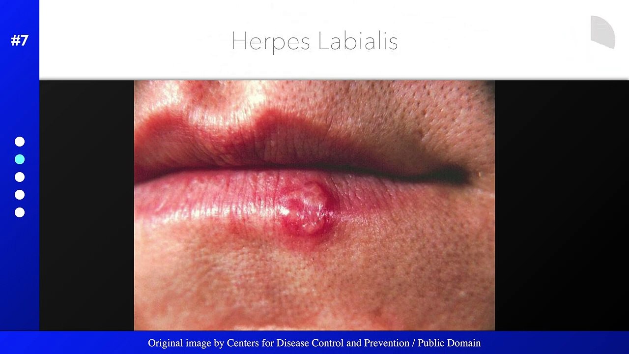 Dermatology Quiz Challenge