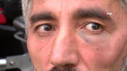 Tuzla'da gazeteciyi sokak ortasında darp ettiler