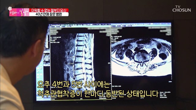 한평생 고된 노동으로 무너진 엄마의 허리 상태는!? TV CHOSUN 20221106 방송