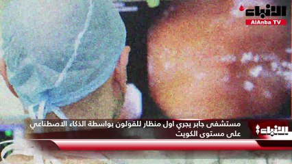 مستشفى جابر يجري أول منظار للقولون بواسطة الذكاء الاصطناعي على مستوى الكويت