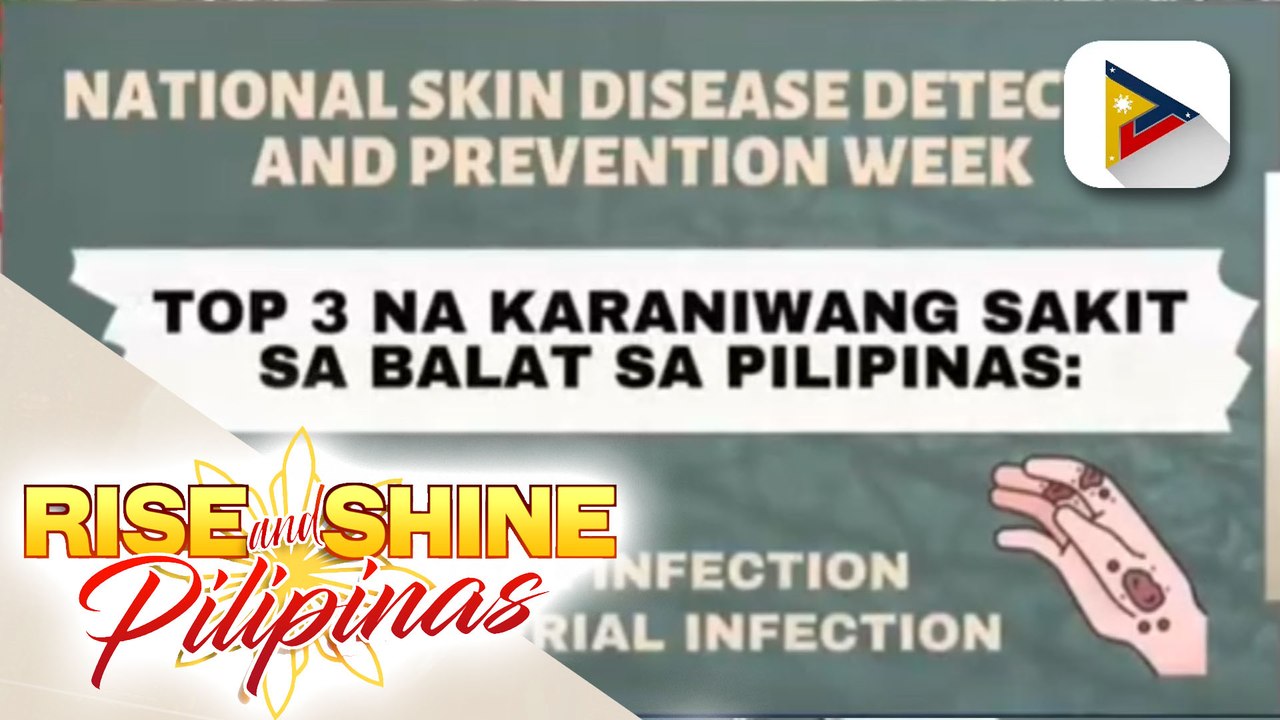 SAY NI DOK | Alamin ang mga pinaka-karaniwang sakit sa balat ng mga Pilipino at paano malulunasan ang mga ito