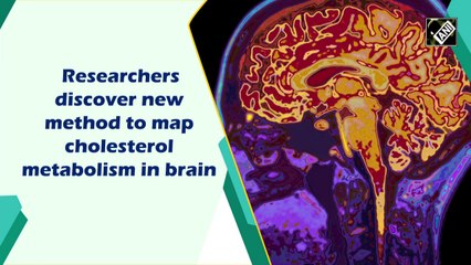 Researchers discover new method to map cholesterol metabolism in brain