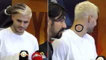 Galatasaraylı futbolcu Icardi'nin boynundaki morluk maç sonuna damga vurdu