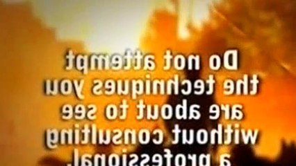 The Dog Whisperer Season 3 Episode 11 Dexter And Nasir (The Diva's Miracle Worker)