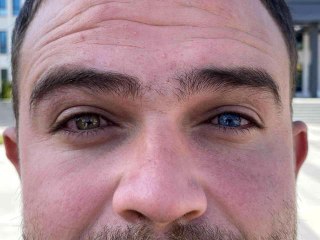 Bir gözü mavi, bir gözü yeşil olan adamı gören şaşırıyor