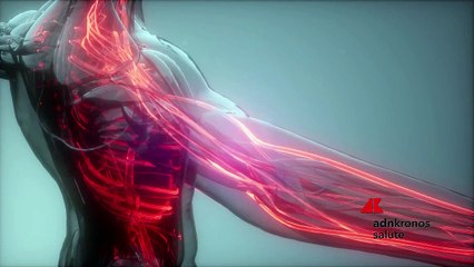 Trombocitopenia indotta da eparina, nuova terapia disponibile in Italia