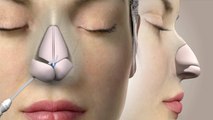 नाक की हड्डी क्यों बढ़ती है | Kyu Badhti Hai Naak ki Hadi| Boldsky *Health