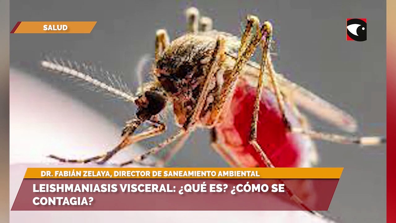 Leishmaniasis visceral: ¿qué es? ¿cómo se contagia?