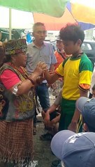 Street Reflexology | Broken arm