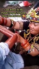 Amazing Street Reflexology | Broken arm