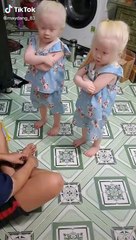 Đôi song sinh bạch tạng có nhan sắc trái ngược