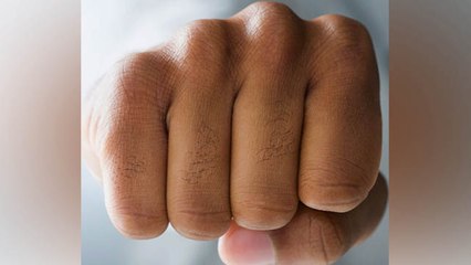 उंगलियों पर बाल क्यों उगते हैं ? उंगलियों पर बाल उगने का कारण | Boldsky *Health