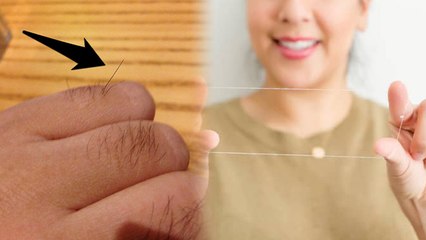 उंगलियों के पीछे उगे बाल हटाने के लिए अपनाएं ये उपाय | Boldsky *health