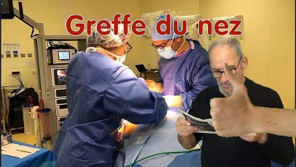 Greffe du nez en un tour de bras