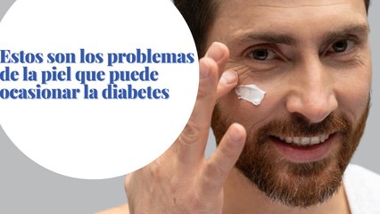 Estos son los problemas de la piel que puede ocasionar la diabetes