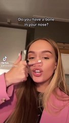 Mujer nace sin el hueso ni cartílago en la nariz y se hace viral en redes sociales