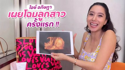 ไอซ์ อภิษฎา เผยโฉมลูกสาวครั้งแรก ตื่นเต้นมากใกล้เป็นคุณแม่แล้ว