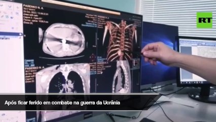 Munição não detonada é removida dentro de corpo de militar russo