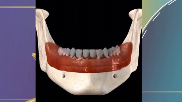 bd-implantes-dentales-y-cuidados-que-requiern-101122