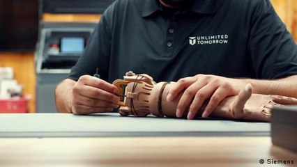 Inventor revolutionizes prosthesis production