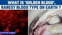 Golden Blood: All about the rare blood type which has 9 donors in the world | Oneindia News *News