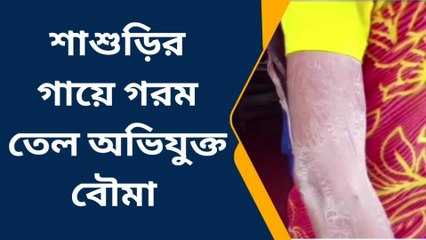ময়নাঃ নির্মম অত্যাচার ! শাশুড়ির গায়ে গরম তেল ঢেলে দিল বৌমা ! দেখুন ভিডিও