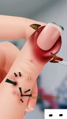 ASMR  fingertreatment animation satisfyingasmr shorts