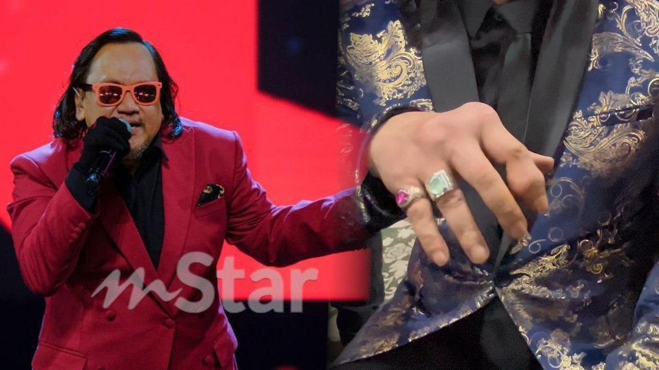 Terkejut tengok tangan Asheed (Def Gab C), bengkak teruk akibat gout