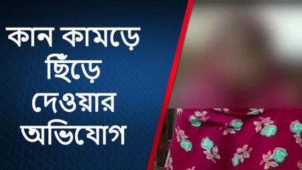কুপ্রস্তাবে রাজি না হওয়ায় কান কামড়ে ছিঁড়লো ভাসুর; তারপর যা হলো..