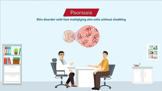 Psoriasis, its causes and treatment Skin Care
