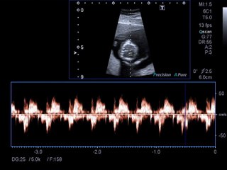 Dr David Gerber - Leading Labiaplasty Surgeon