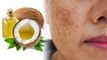 नारियल तेल लगाने से क्या चेहरा काला होता है ?।चेहरे पर नारियल का तेल लगाने से क्या होता है | Boldsky