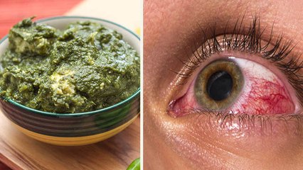 सरसों का साग खाने से क्या होता है ।  सरसों का साग खाने के फायदे । Boldsky *Health