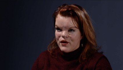 Clémence Bellanger, atteinte de malformations physiques : "Les médecins ont été très maladroits avec mes parents à ma naissance"