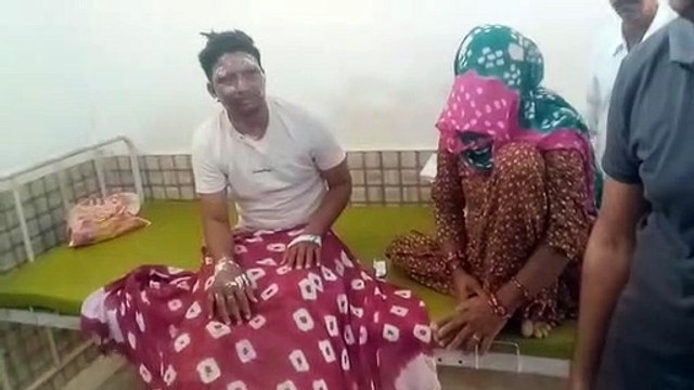 गैस गीजर की पाइप फटी, सगे भाई-बहन सहित तीन झुलसे