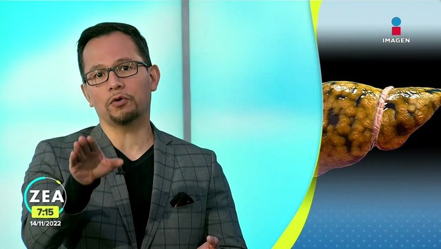¿Qué es es el hígado graso?